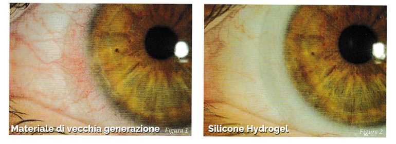 scelta lenti a contatto torino
